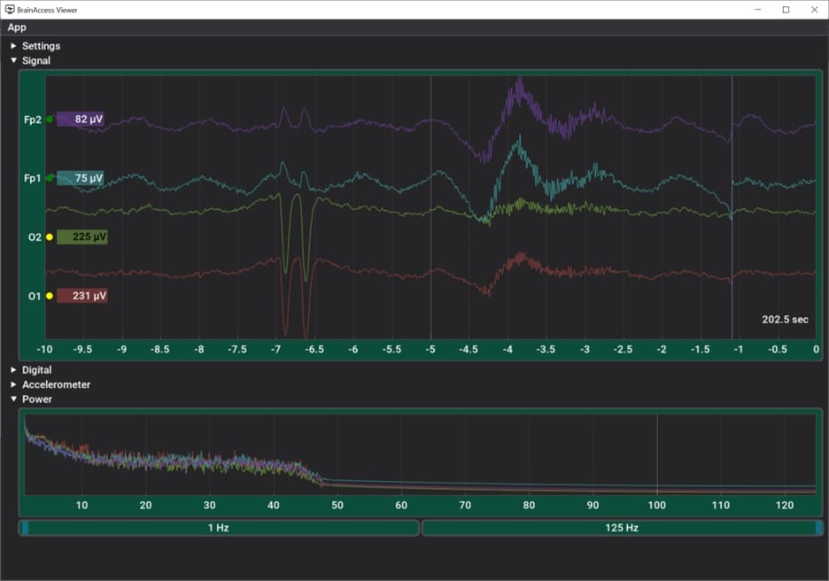 EEG Signal Quality - BrainAccess