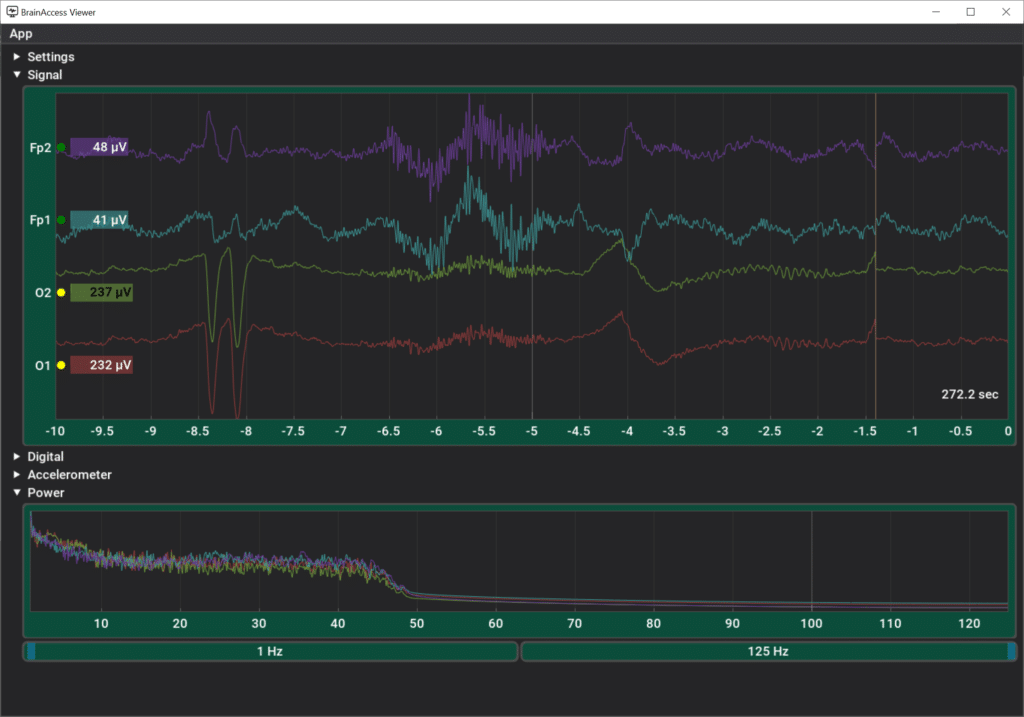 Starting up with BrainAccess Board - BrainAccess Starting up with BrainAccess Board - BrainAccess