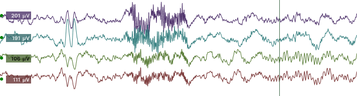 Understanding EEG Power: Beyond the Brainwaves - BrainAccess Understanding EEG Power: Beyond the Brainwaves - BrainAccess