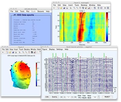 Open-Source EEG Analysis Tools: Making Brain Research More Accessible - BrainAccess